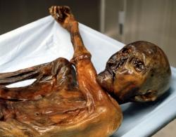 Ötzi Son bras a été replié par le mouvement des glaces.