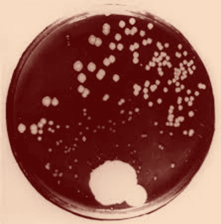 Photo historique de la boite de Fleming montrant l’antagonisme entre une moisissure, le Penicillium, et des bactéries.