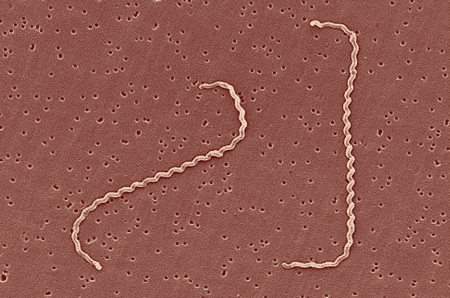Cette bactérie a besoin d'eau. Elle se déplace très rapidement "à la façon d'un tire bouchon" C'est une cousine de la Borrelia médiatique (Lyme) et de l'indéboulonnable Tréponème de la Syphilis.