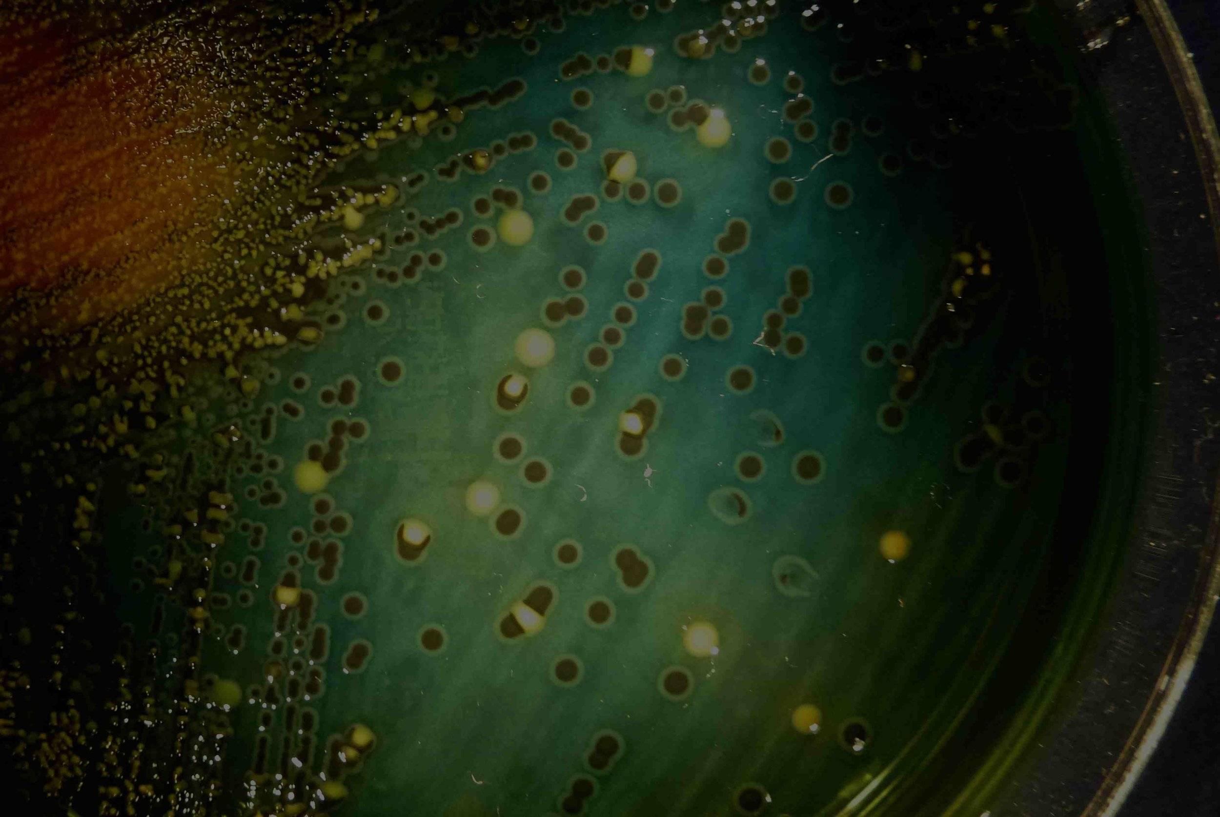 Bacille de la typhoïde : colonies sur gélose.