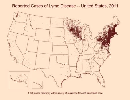 Cette maladie est bien plus fréquente aux Etats-Unis qu'en France