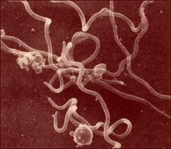 La Borrelia, spiralée, est une bactérie &nbsp;très rapide en milieu gel