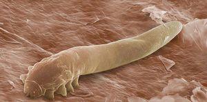 Demodex follicorum 